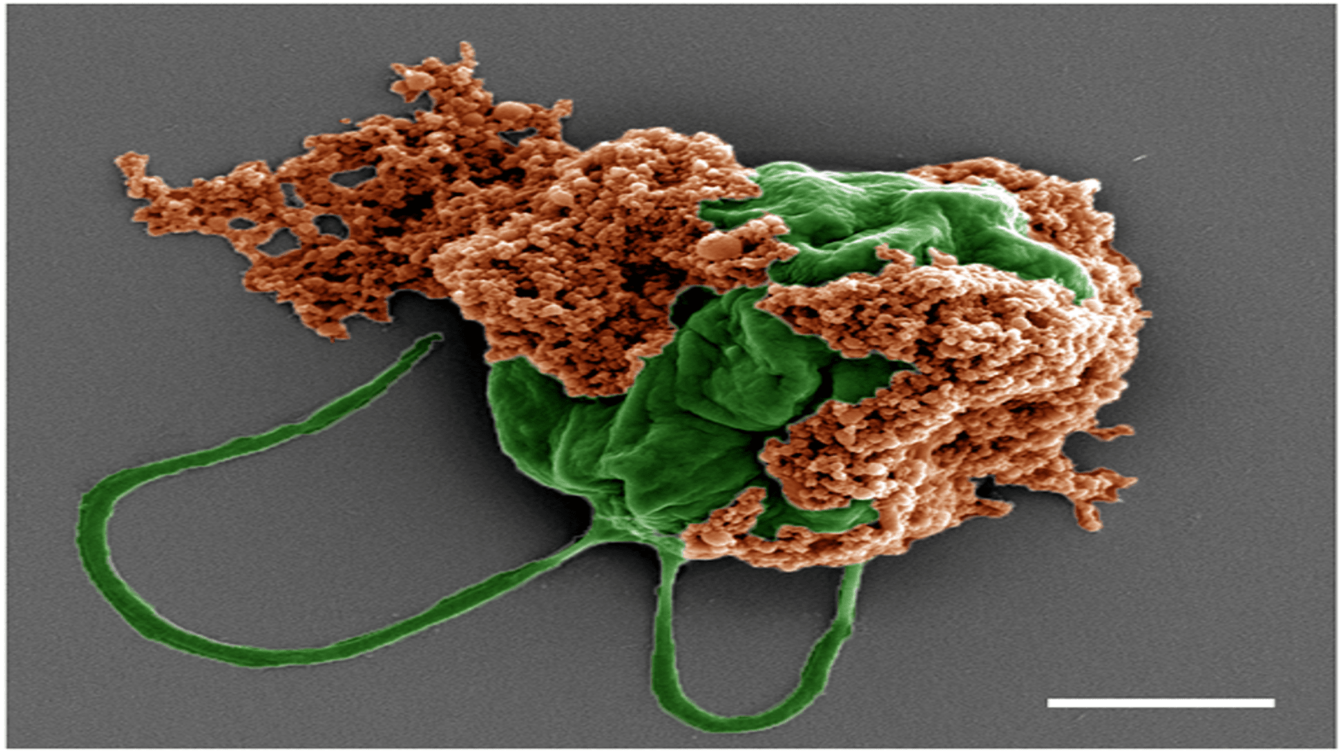 Algae-made microrobots help increase lung cancer survival rate by 40%