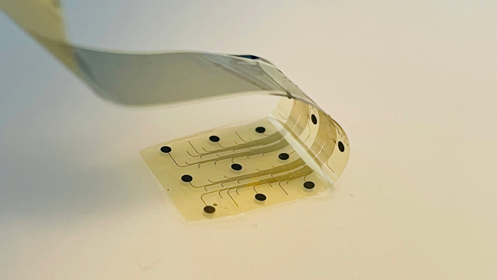 ‘World’s first’ graphene brain chip implanted in a cancer patient