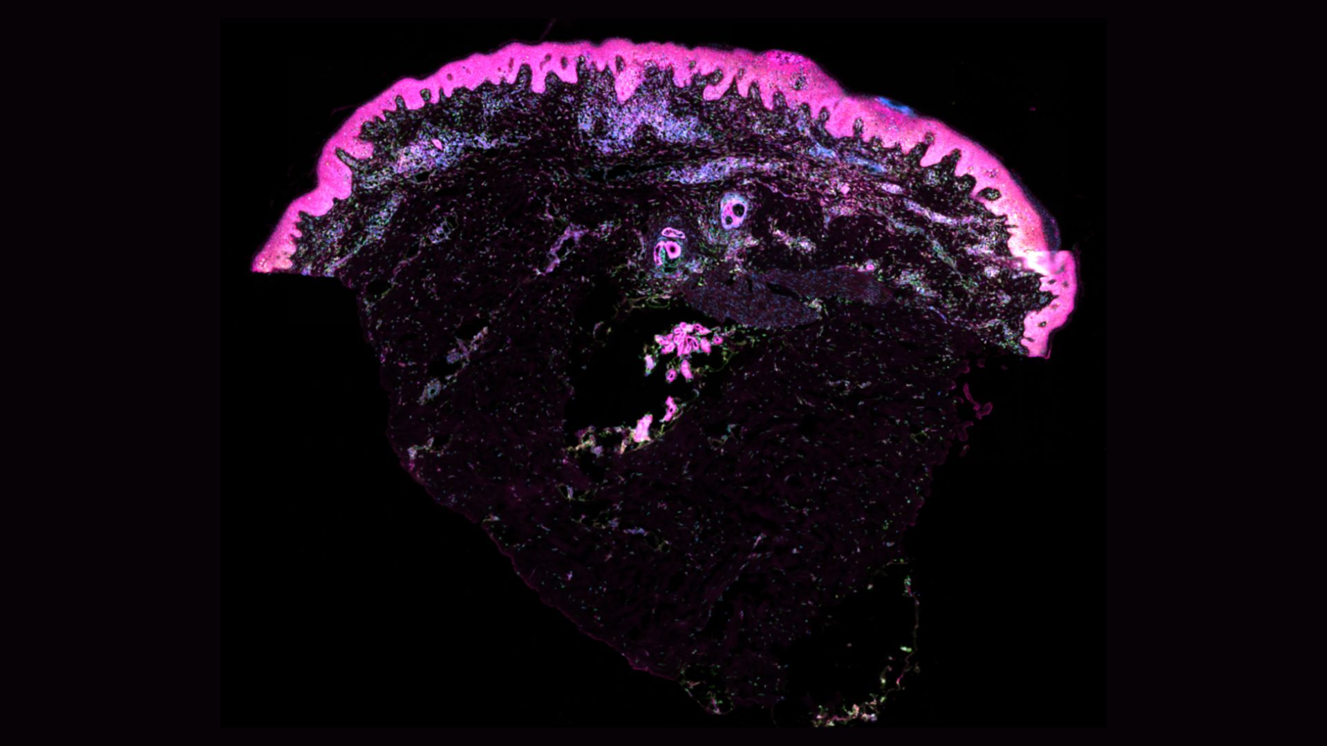 Un corte transversal microscópico de tejido de piel humana, resaltado con colores fluorescentes. La capa más externa de la piel aparece en tonos rosa y púrpura brillantes, destacando la estructura de la epidermis, mientras que las capas internas se ven más oscuras y detalladas en diversas tonalidades. La sección revela una vista detallada de los folículos pilosos y otras estructuras celulares dentro de la piel. Este tipo de imagen es comúnmente utilizado en estudios de desarrollo prenatal y análisis de enfermedades cutáneas.