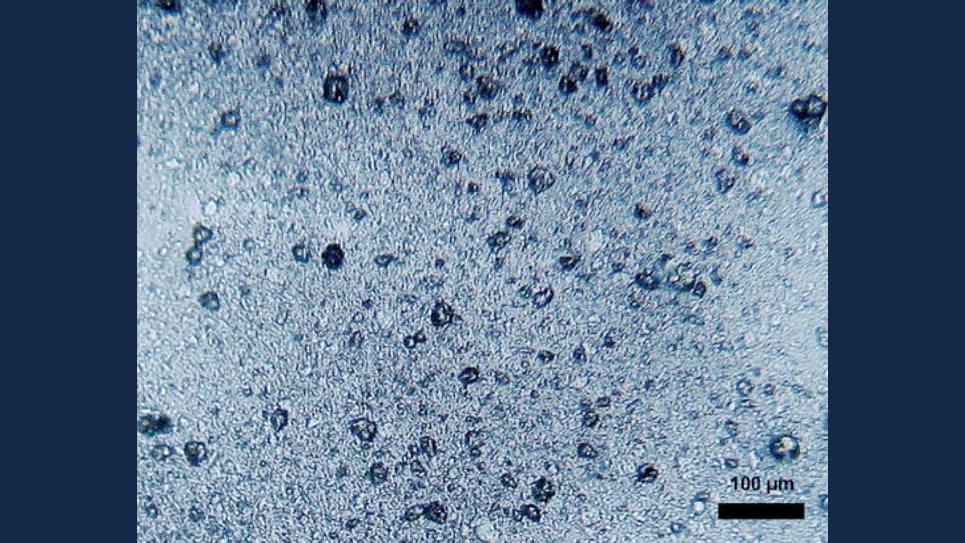 No place left untouched: The invisible threat of microplastics