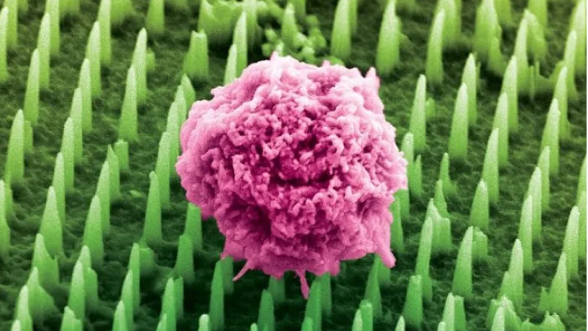 Scientists develop painless biopsy patch thinner than a human hair