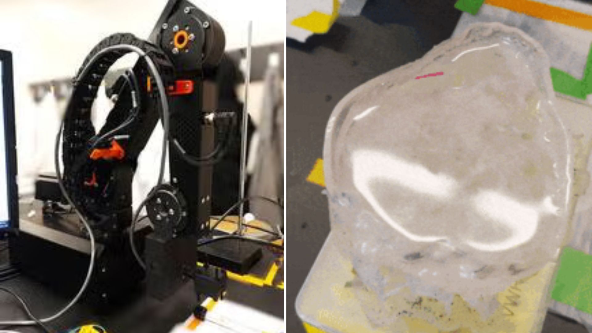 New soft 'robot’ may offer pain-free way to treat kidney stones