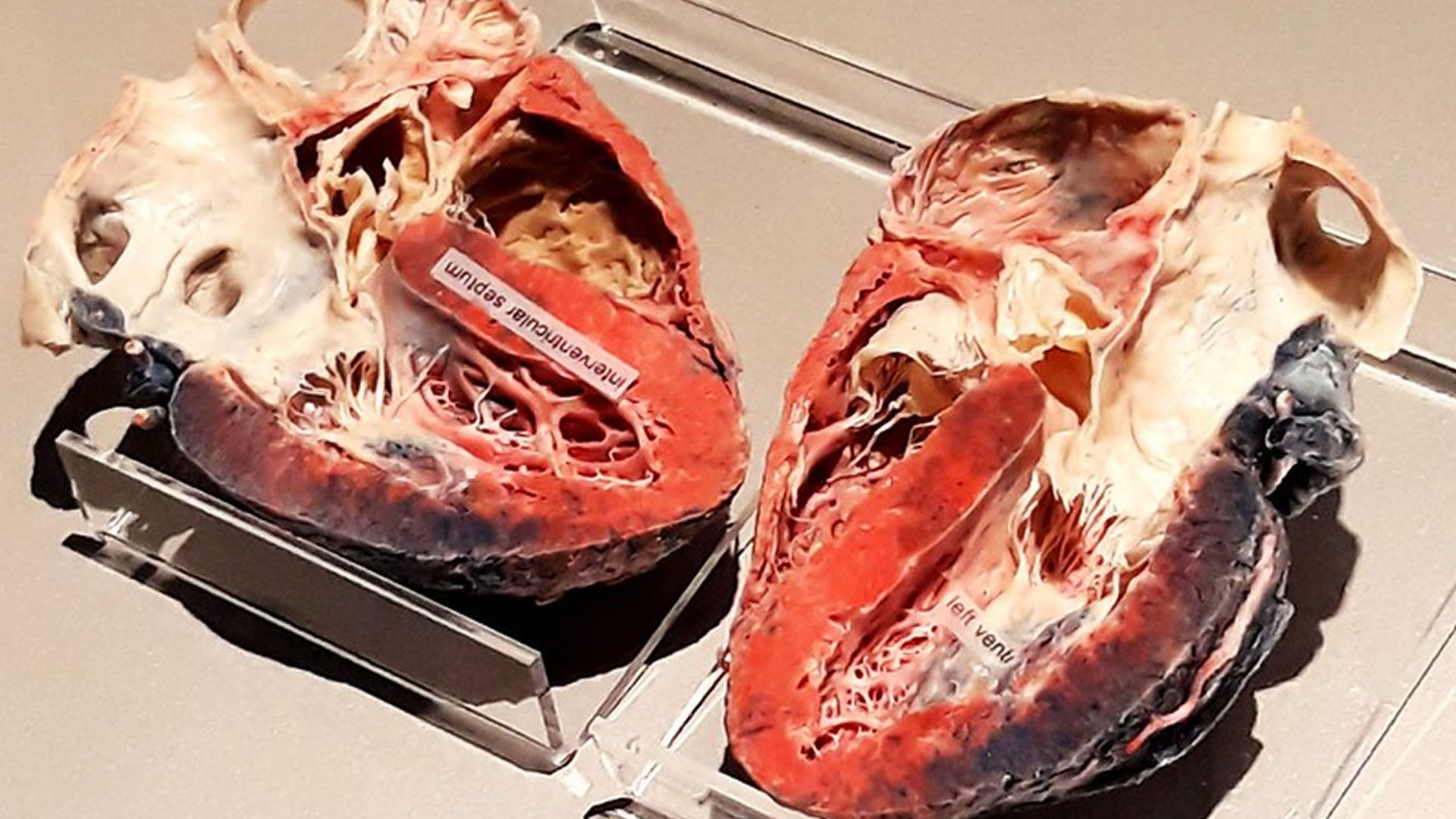 China’s ‘ionic glass’ method turns brains and hearts transparent for 3D mapping