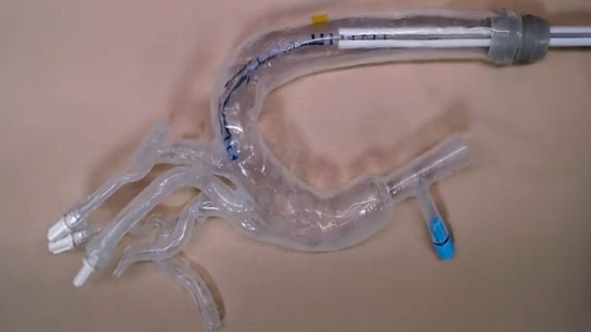 Vine-inspired soft robot grows its way through arteries, jet engines