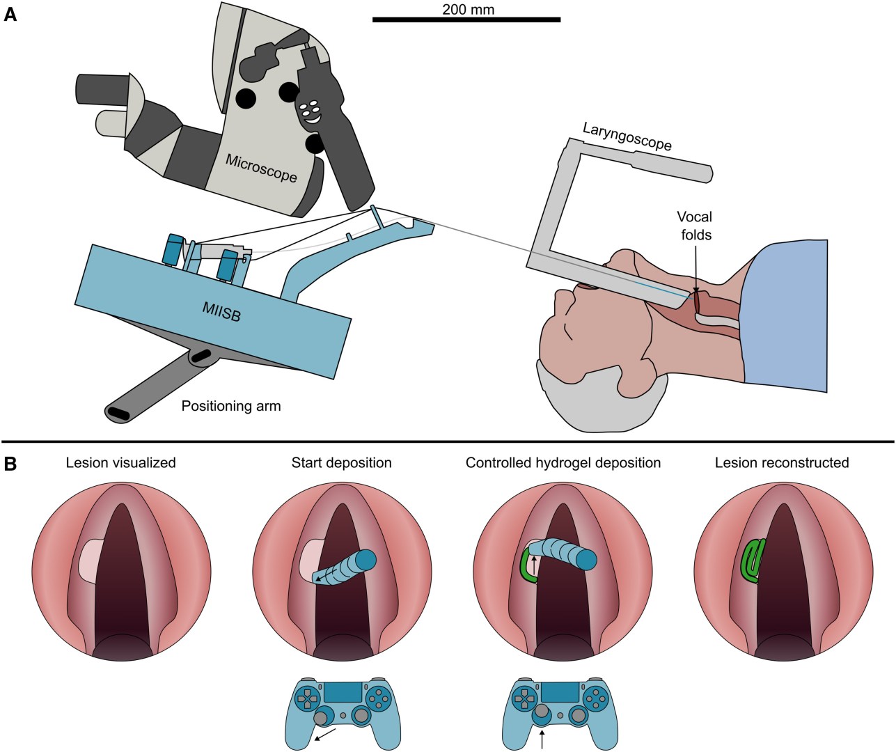 World’s Smallest 3D Bioprinter: A Breakthrough in Vocal Cord Regeneration