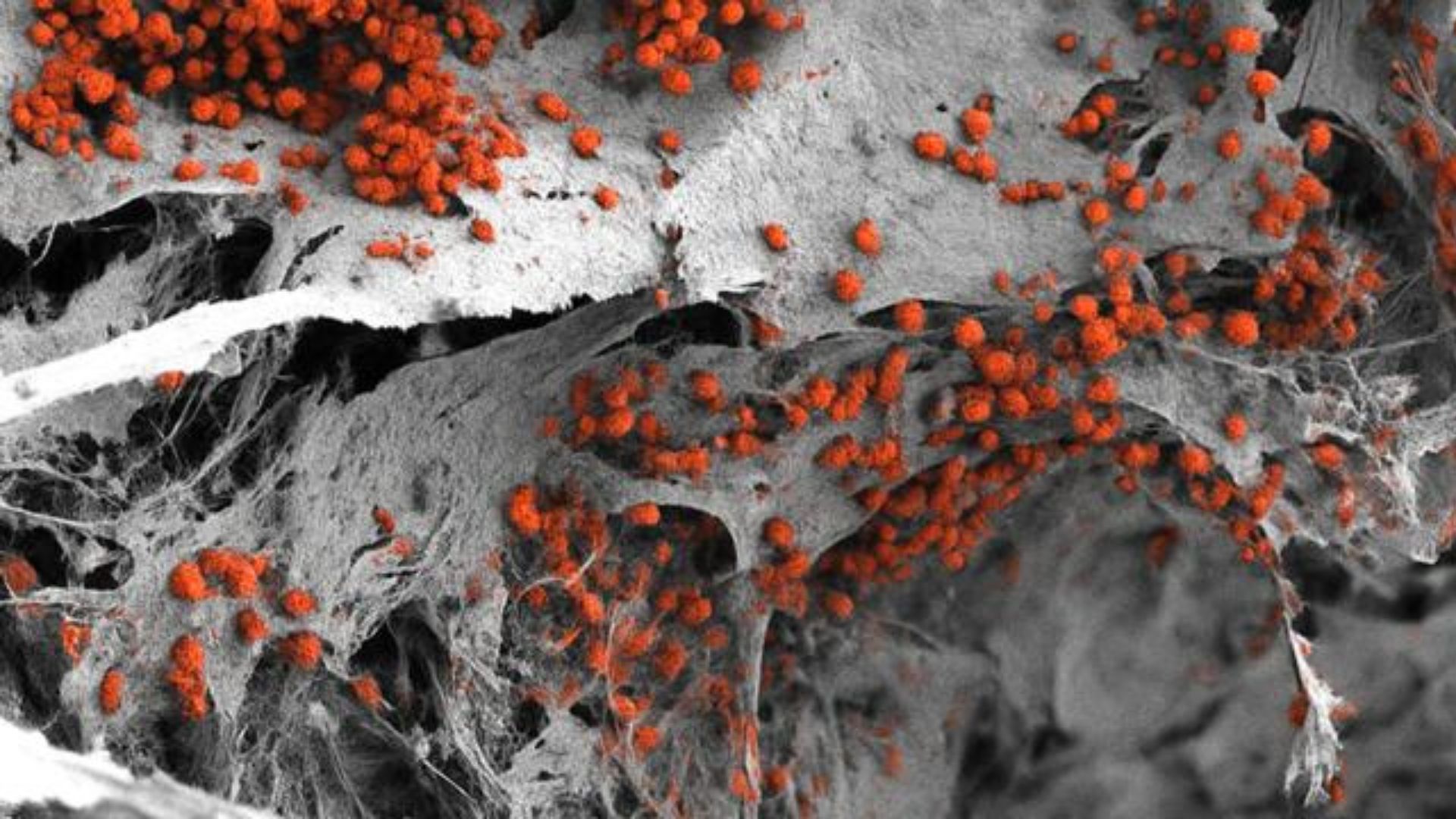 Các nhà khoa học tạo ra mô tủy xương từ tế bào người đầu tiên trong phòng thí nghiệm