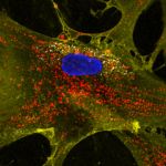 Phương pháp công nghệ nano mới nạp thêm ty thể vào tế bào gốc để tái tạo năng lượng cho các tế bào đang chết dần