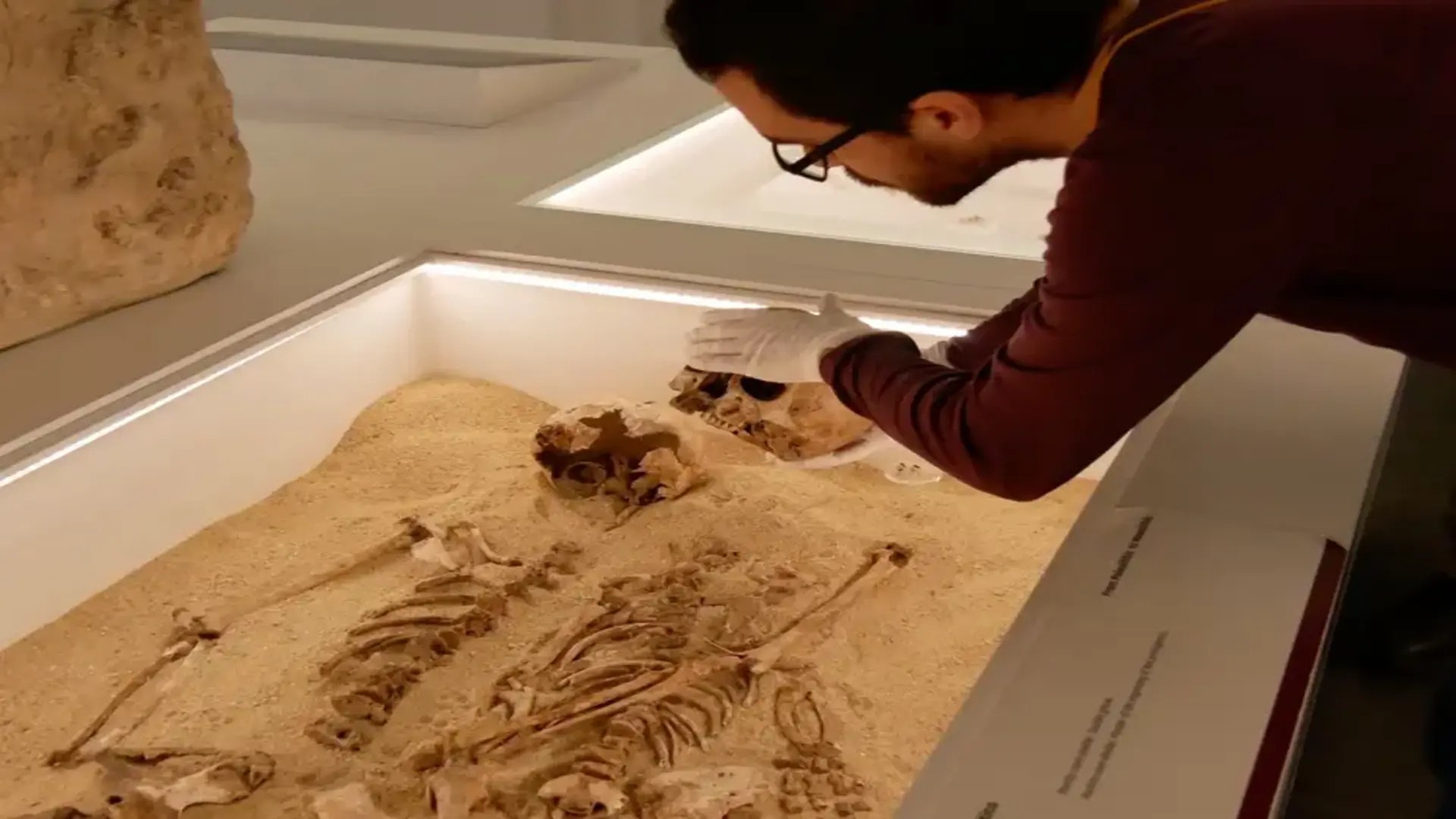 12,000-year-old case of rare genetic disease confirmed in major breakthrough in medicine