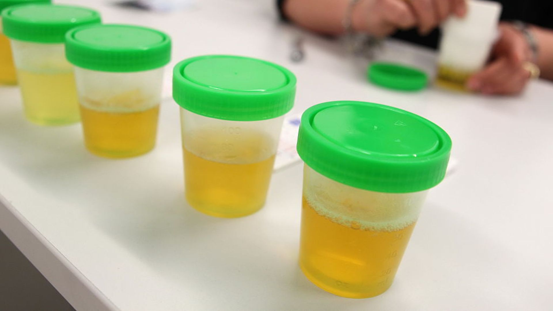 Canada: Nước tiểu người được chuyển hóa thành điện năng bằng pin nhiên liệu vi sinh