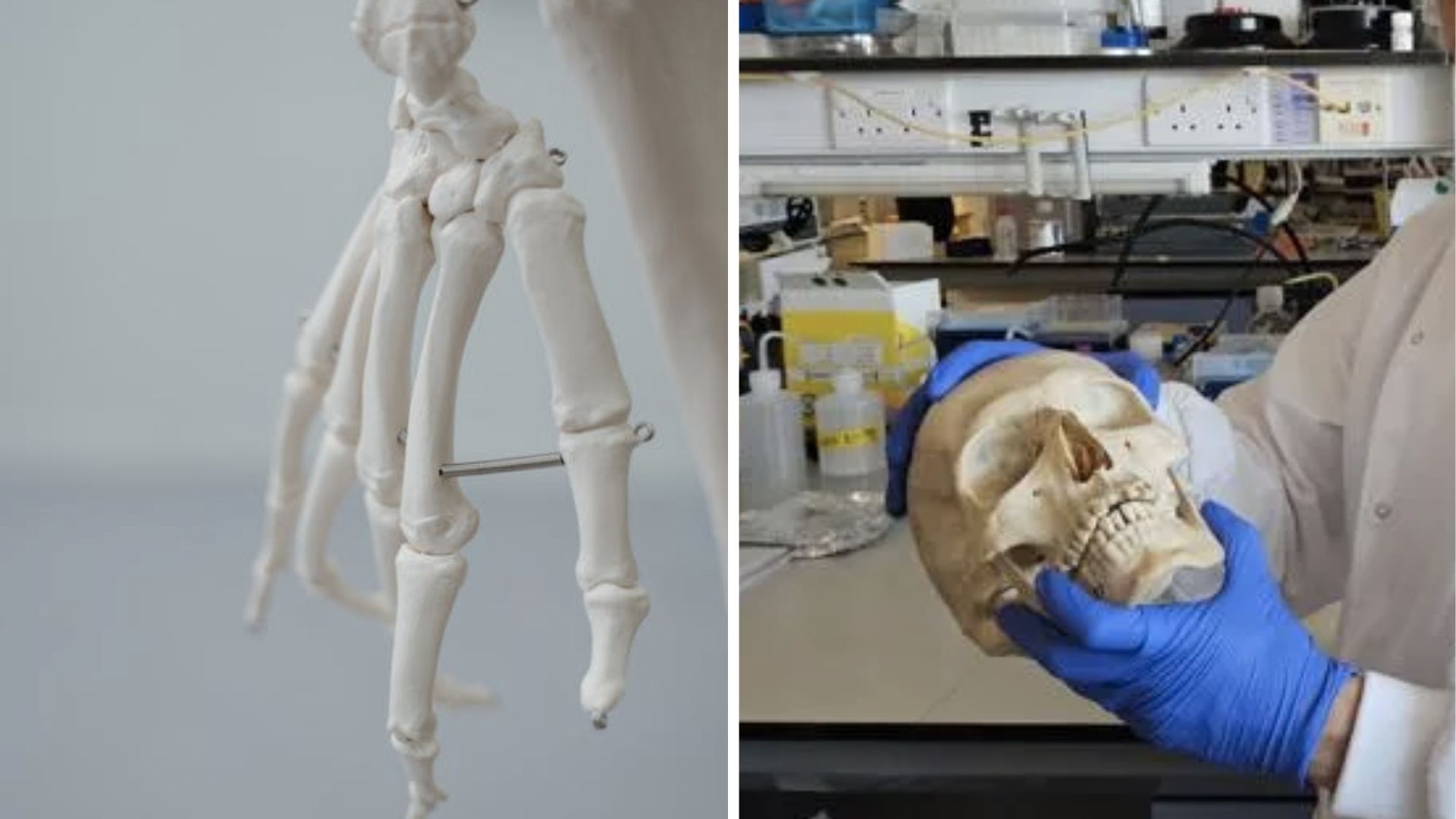 Wool turned into sustainable material for bone regeneration in animals