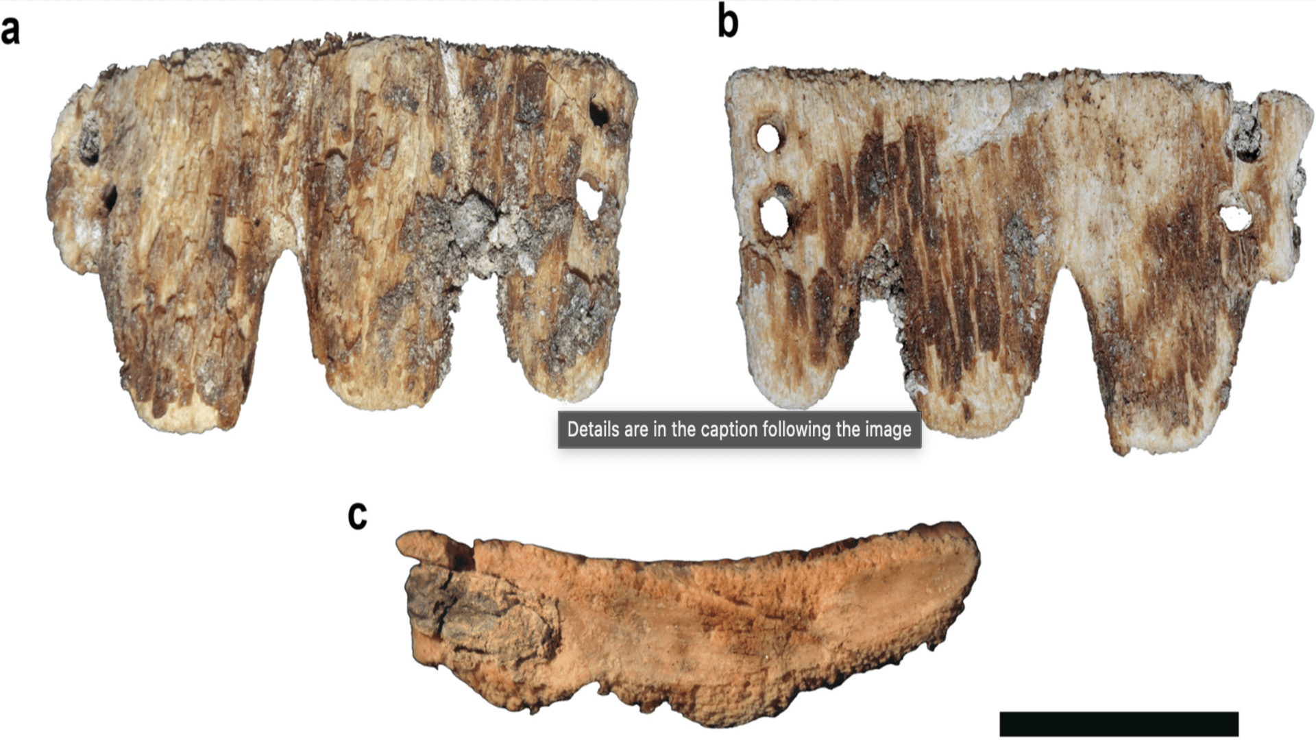 Rare 19th-century dental prosthetic that a wealthy person wore found in Portugal