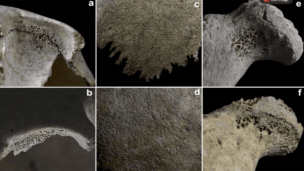 5,000-year-old famous mass grave reveals how ancient disease affected children