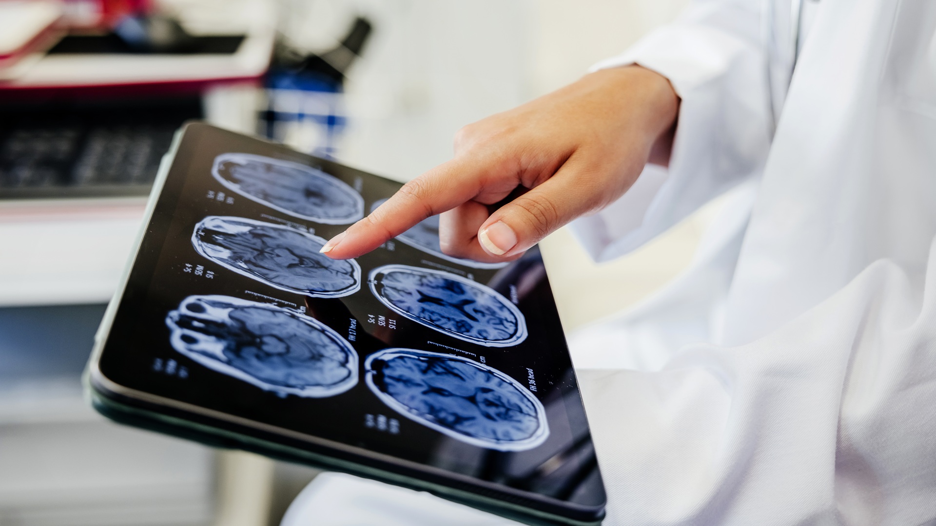 Chinese brain-mimicking chip outperforms NVIDIA A100 on mapping