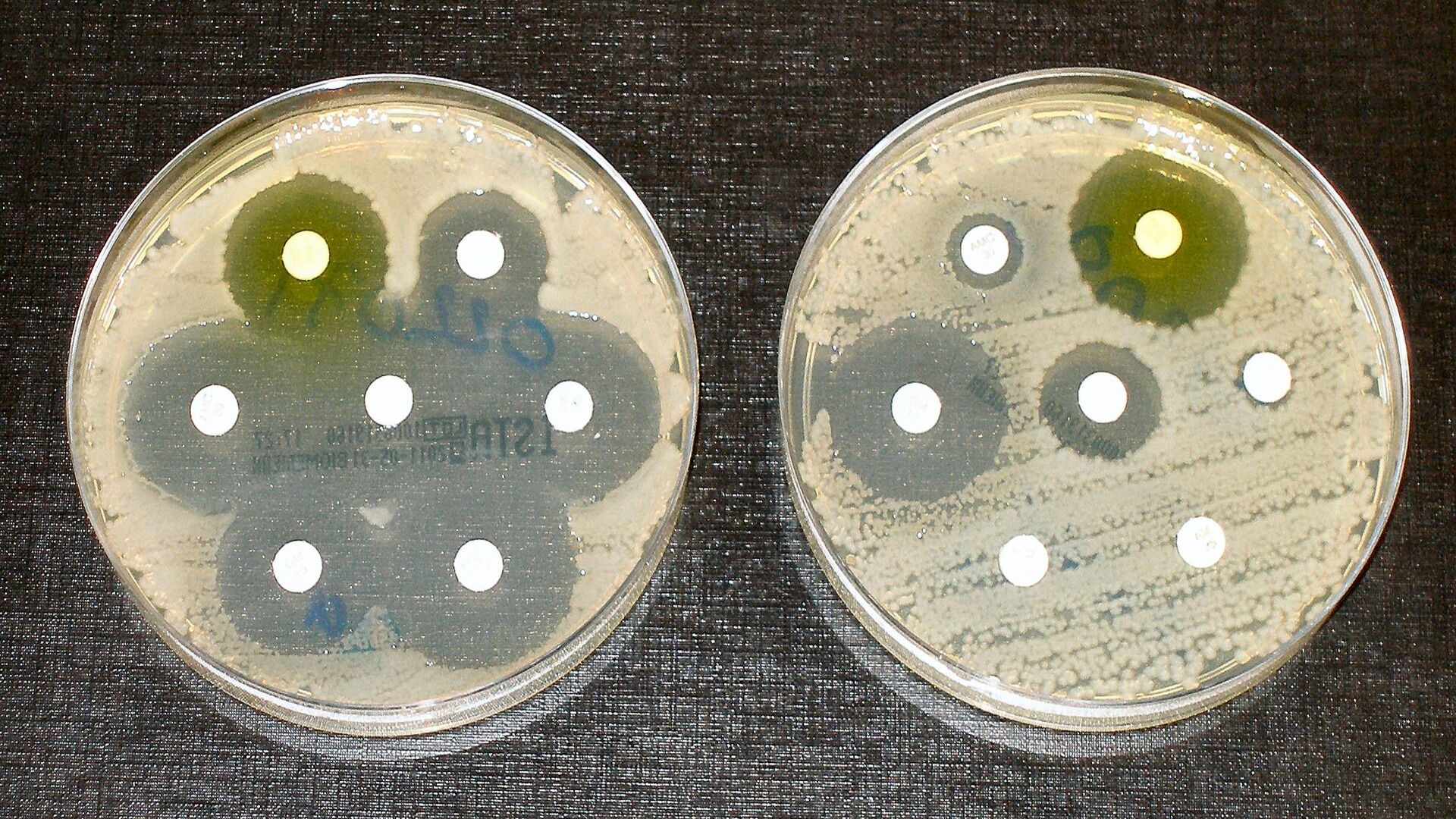 Scientists uncover how insect-killing bacteria could lead to antibiotics
