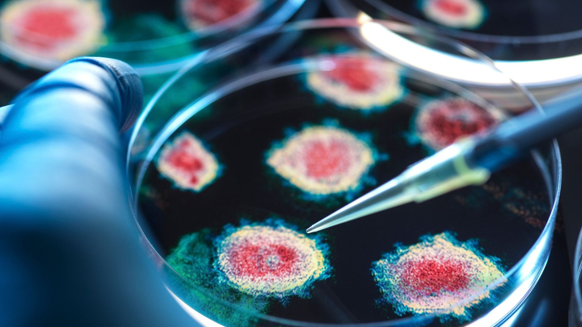 White House tracking suspected plague death and quarantines in Russia